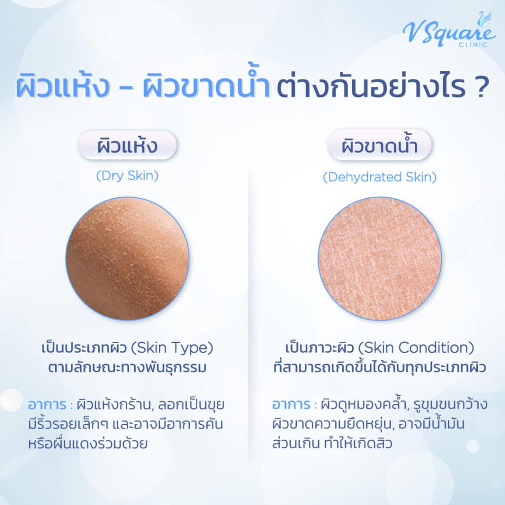ผิวแห้ง ผิวขาดน้ำ