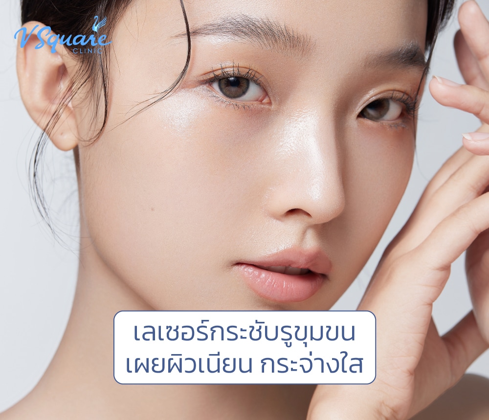 เลเซอร์รูขุมขน