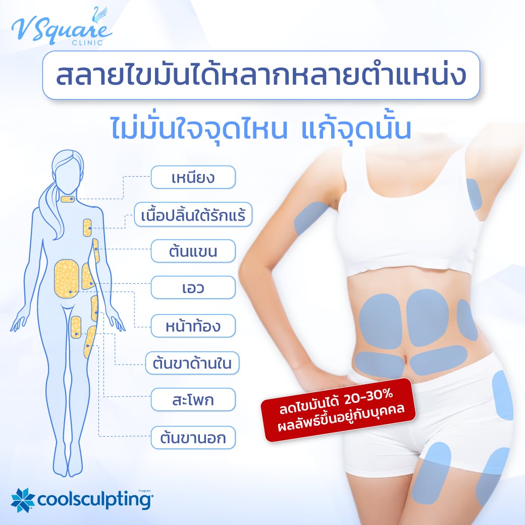 CoolSculpting ทำจุดไหนได้บ้าง