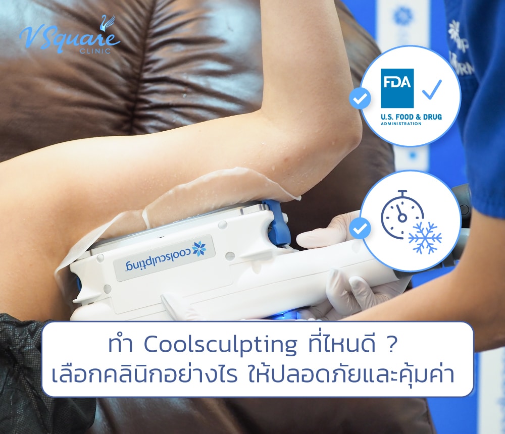 Coolsculpting ที่ไหนดี