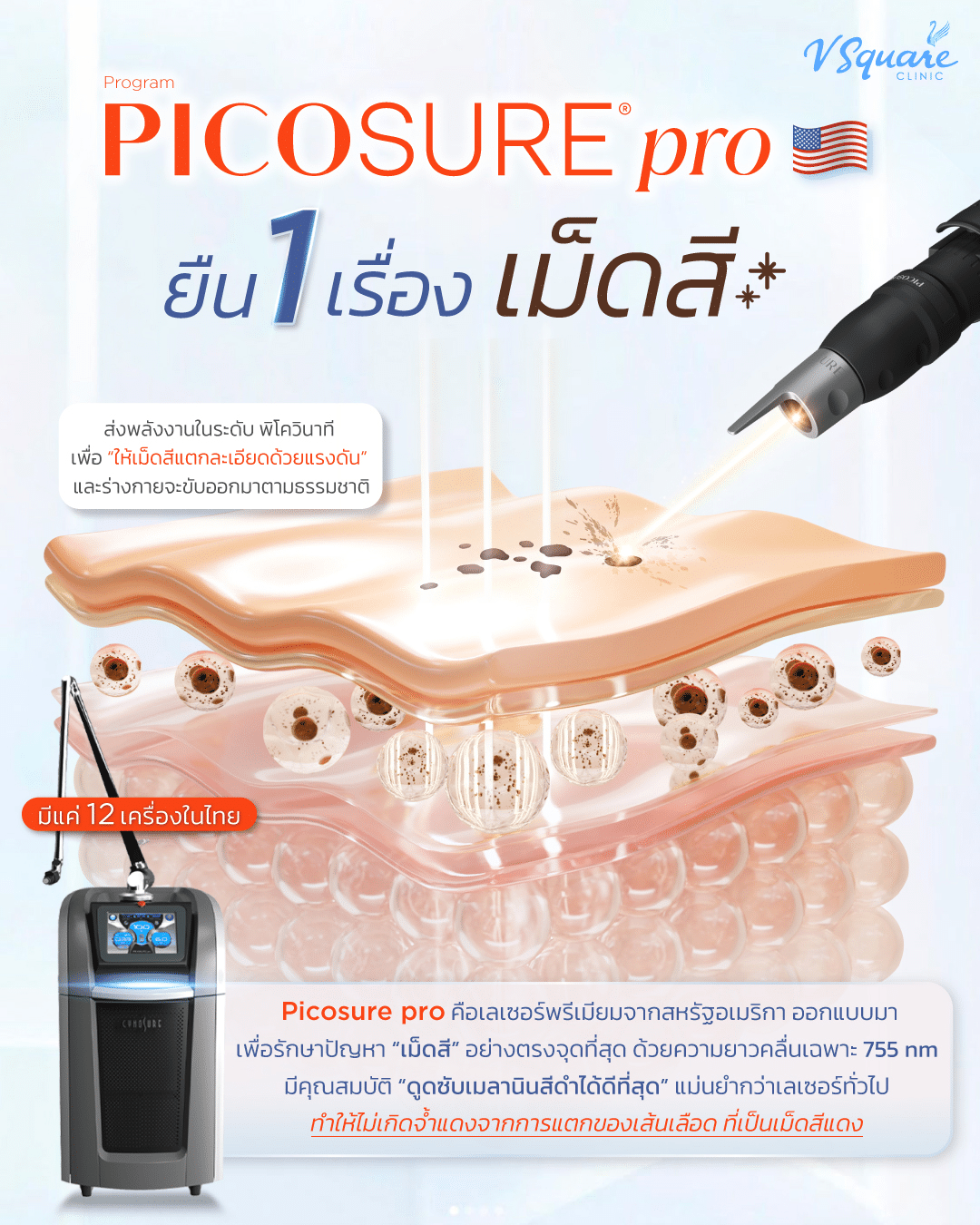 Pico Laser กำจัดเม็ดสี