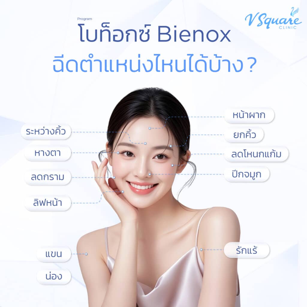 โบท็อก Bienox ฉีดจุดไหนได้บ้าง
