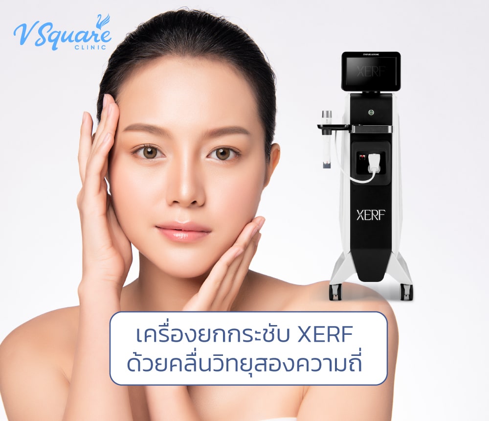 XERF