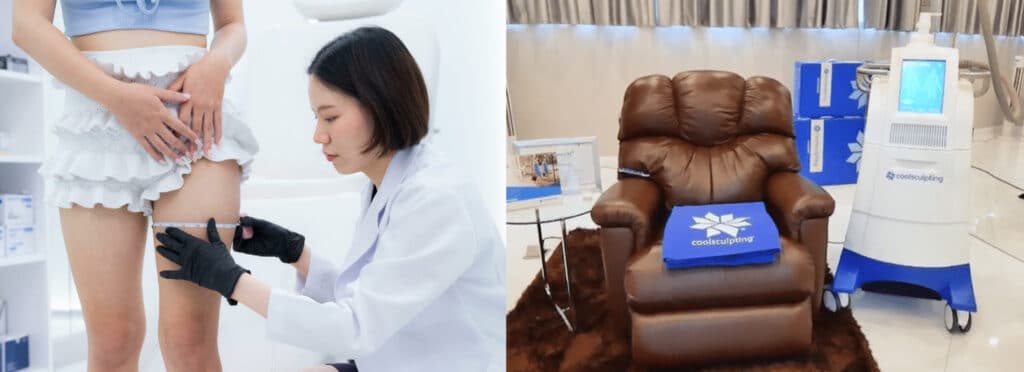 บริการ CoolSculpting V Square โดย พญ.อิษฎา ตระกูลสุข