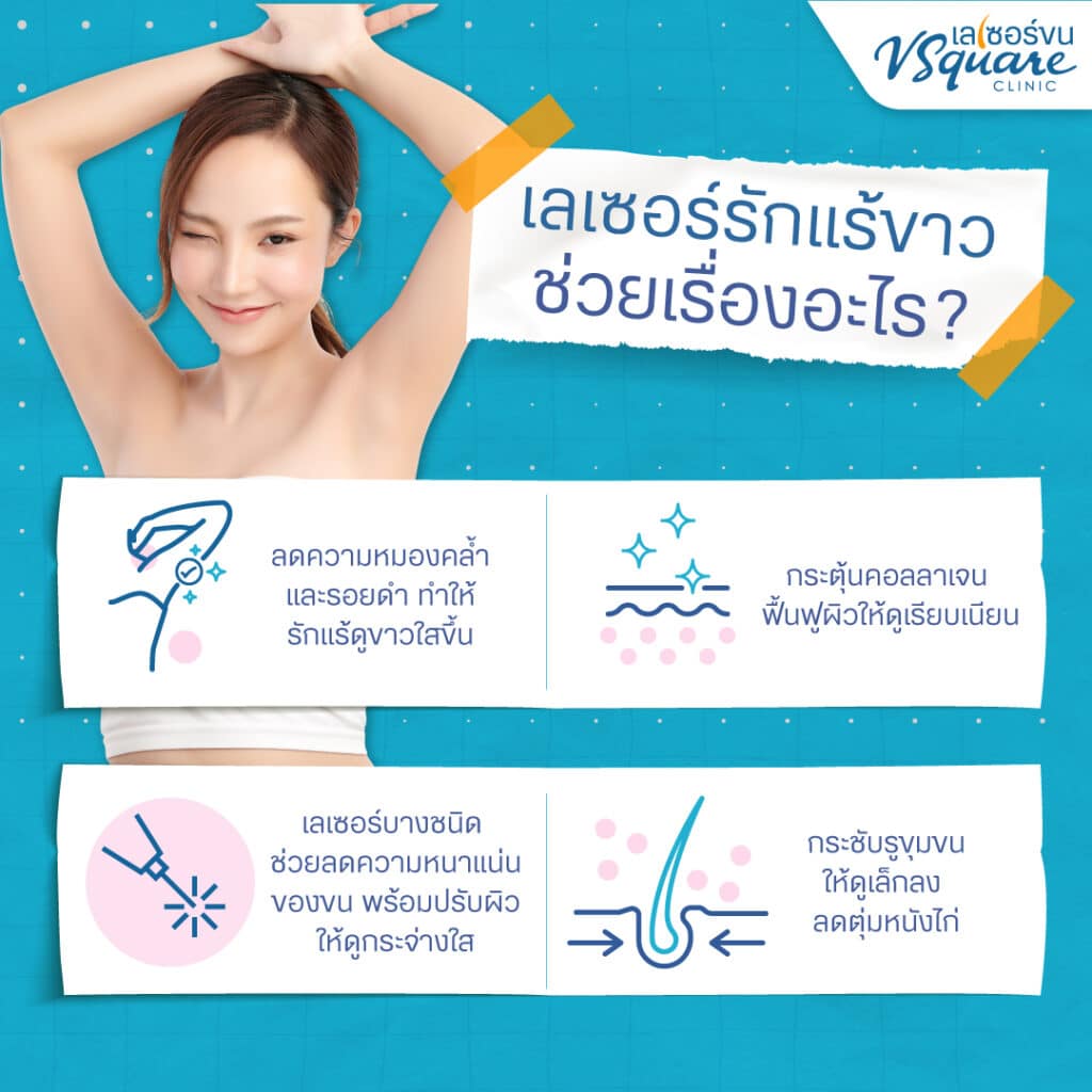 ประโยชน์ของเลเซอร์รักแร้ขาวเนียนใส