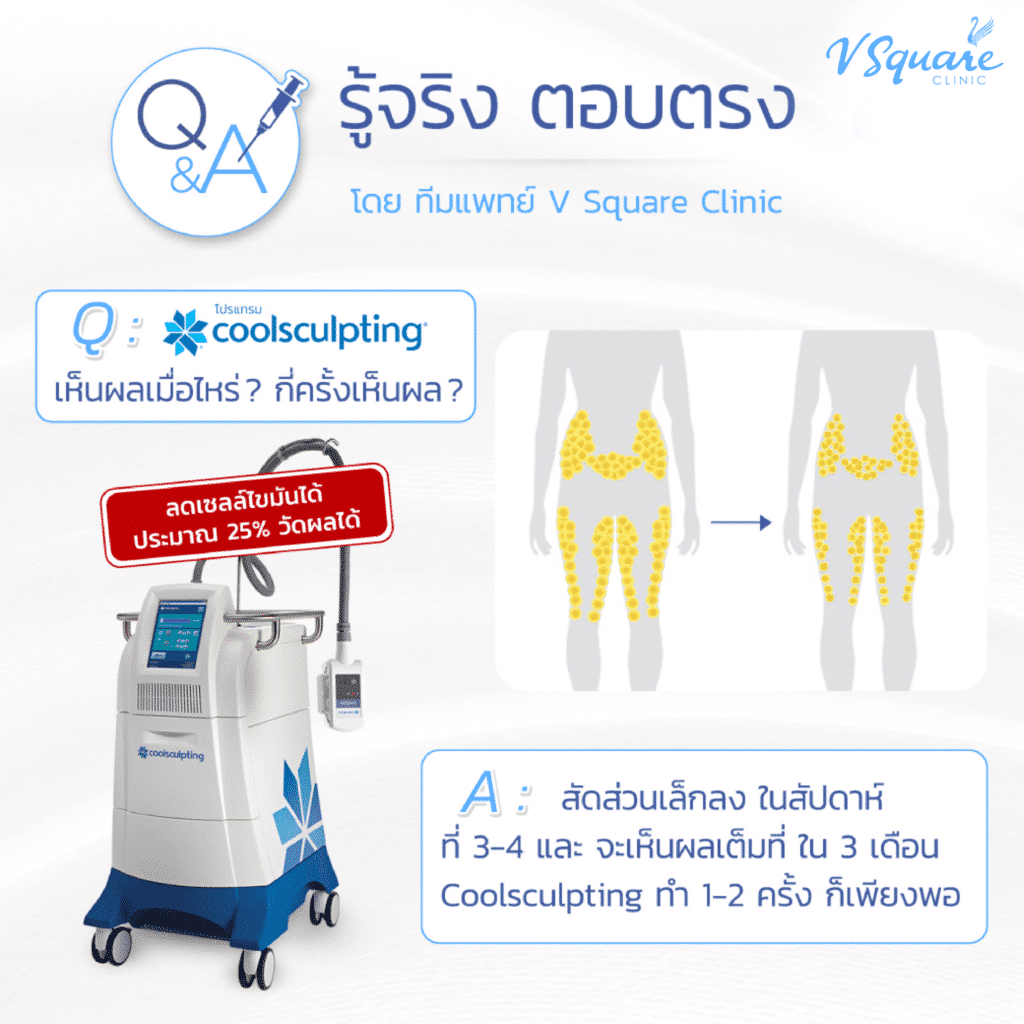 ผลลัพธ์ทำ CoolSculpting