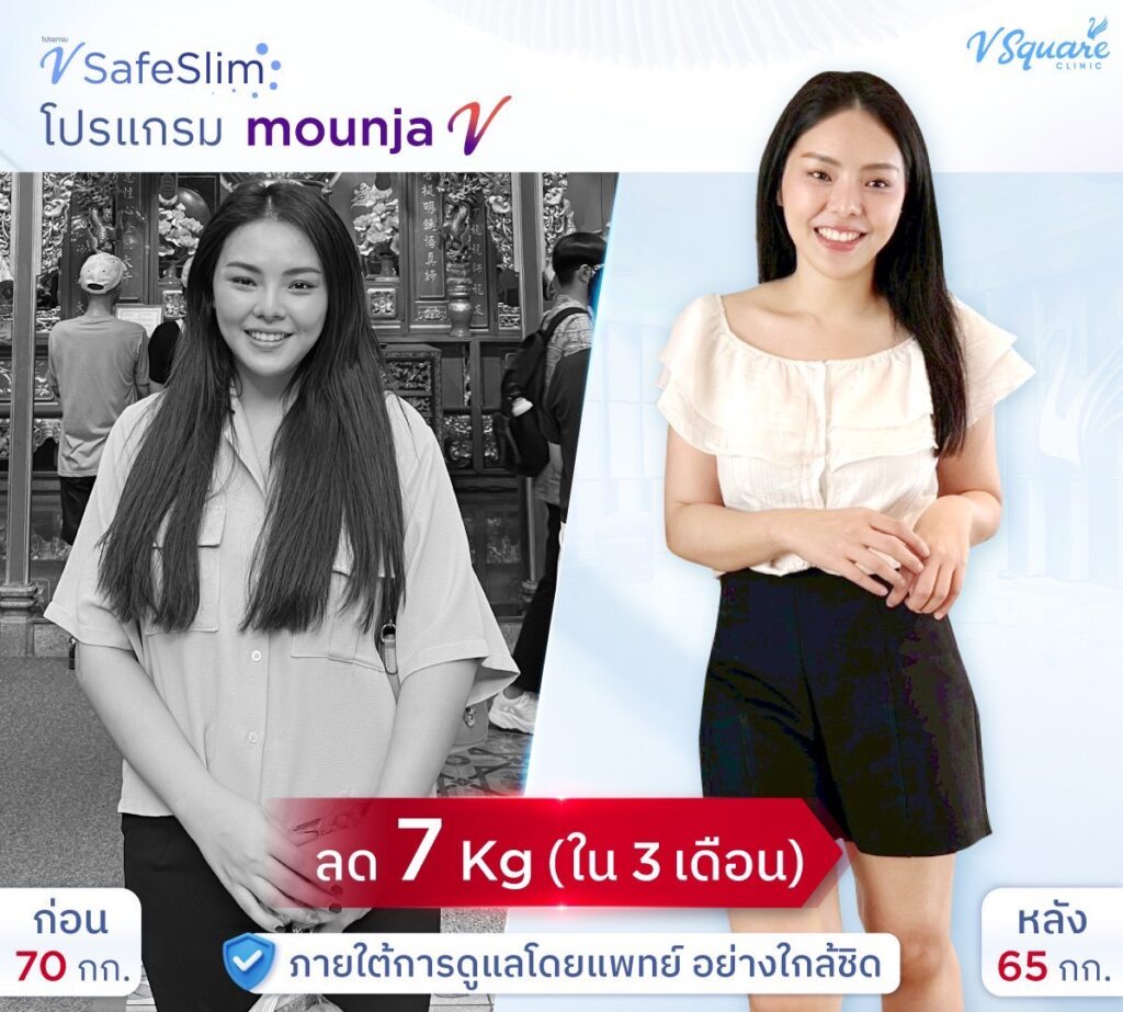 รีวิวผลลัพธ์ฉีดปากกาลดน้ำหนัก3เดือน _