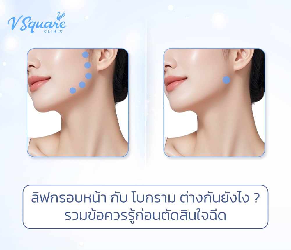 ลิฟกรอบหน้า กับ โบกราม ต่างกันยังไง