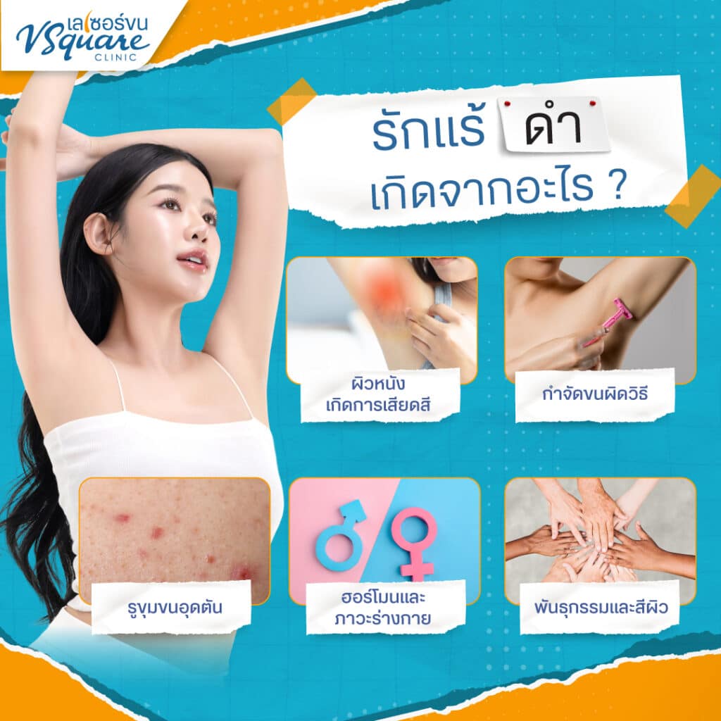 สาเหตุรักแร้ดำ เกิดจากอะไร