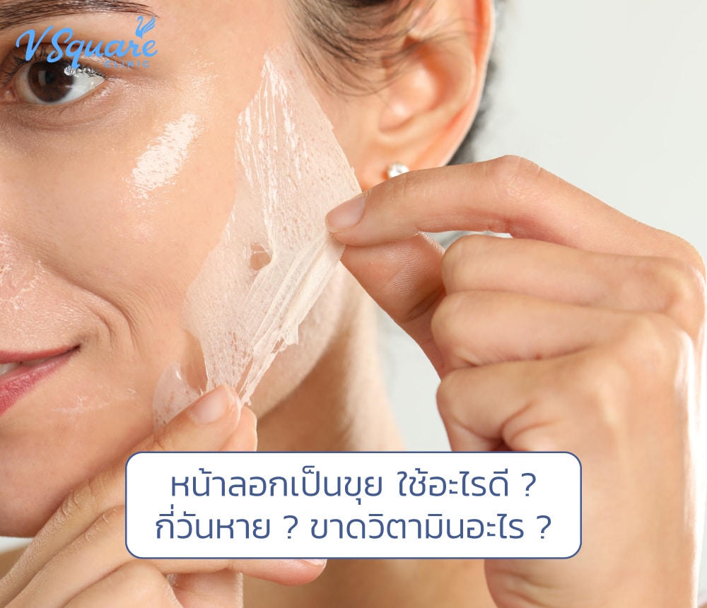 หน้าลอกเป็นขุย