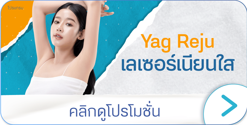 เลเซอร์รักแร้ขาว ราคา