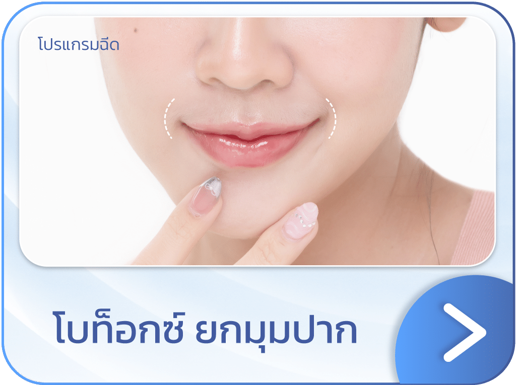 แบนเนอร์ โบท็อกยกมุมปาก