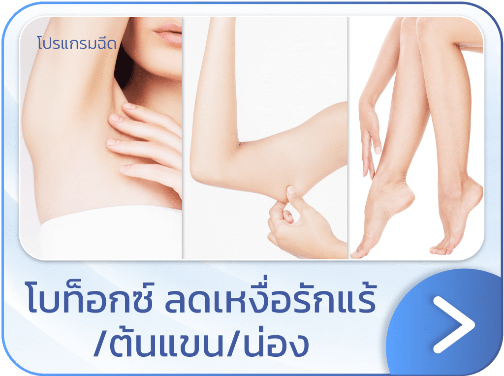 แบนเนอร์ โบท็อกลดเหงื่อ