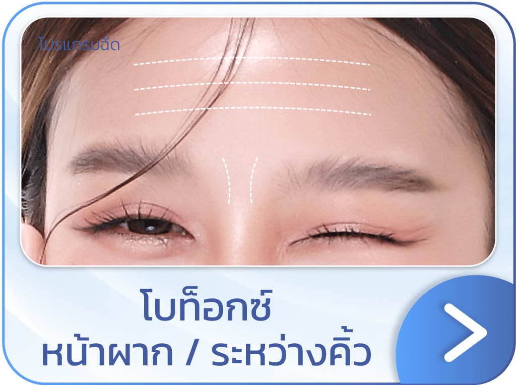 แบนเนอร์ โบท็อกหน้าผาก