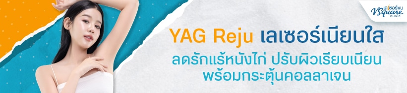 Yag Reju เลเซอร์รักแร้ขาว
