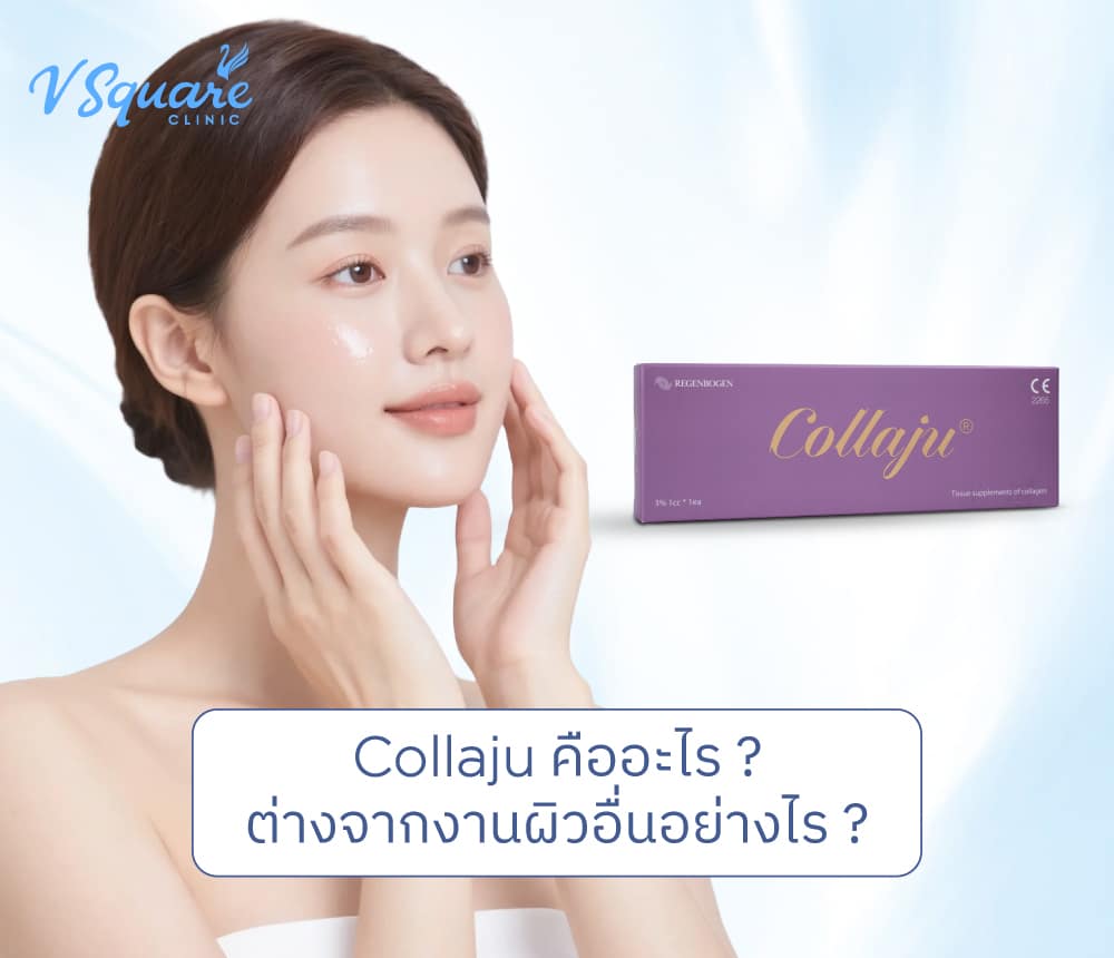 Collaju คอลลาจู