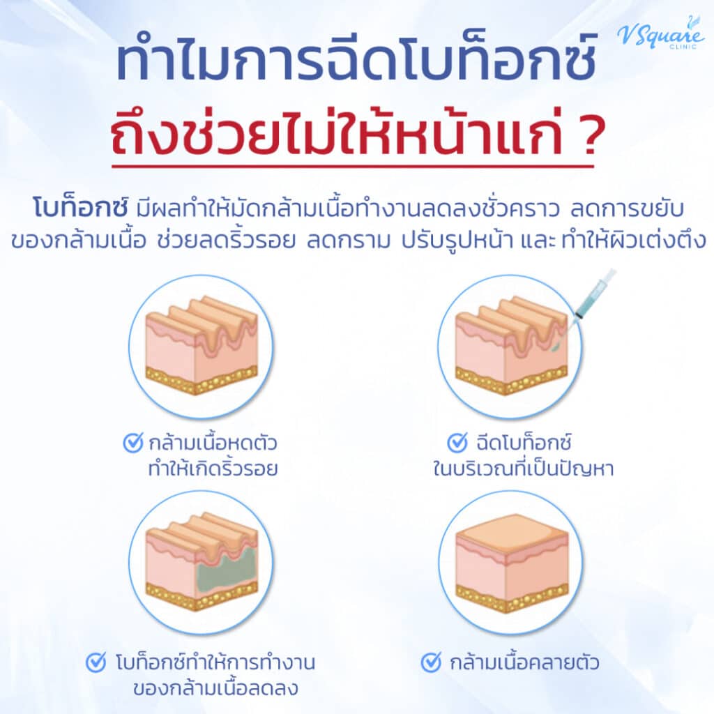 หลักการทำงานของโบท็อก