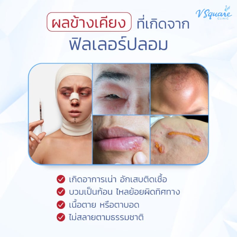 ฉีดฟิลเลอร์ปลอม อันตรายอย่างไร