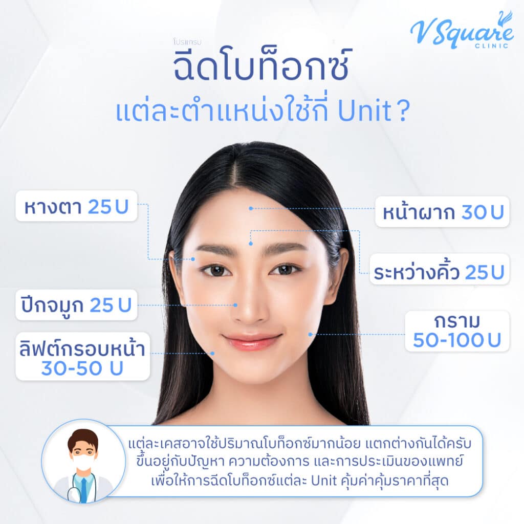 Dysport Botox แบ่งฉีดจุดไหนได้บ้าง