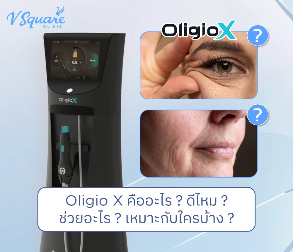 Oligio X