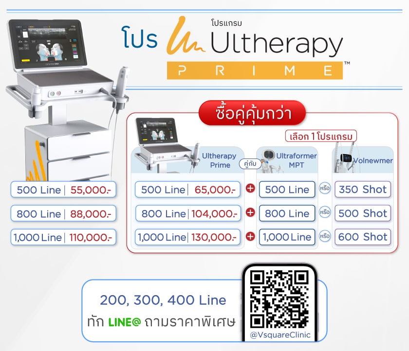 Ulthera Prime ราคาโปร