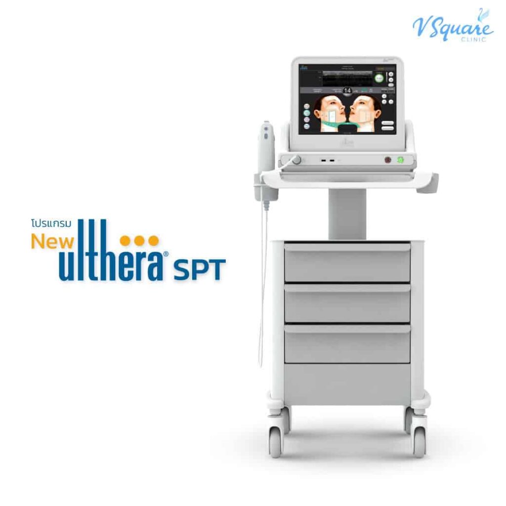 Ulthera คืออะไร