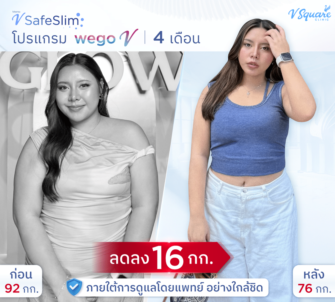 รีวิว V Safe Slim