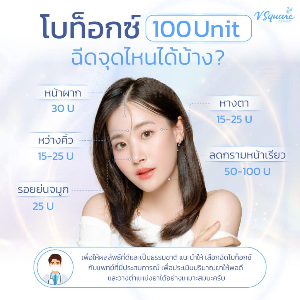 Xeomin 100 ยูนิต ฉีดจุดไหนได้บ้าง