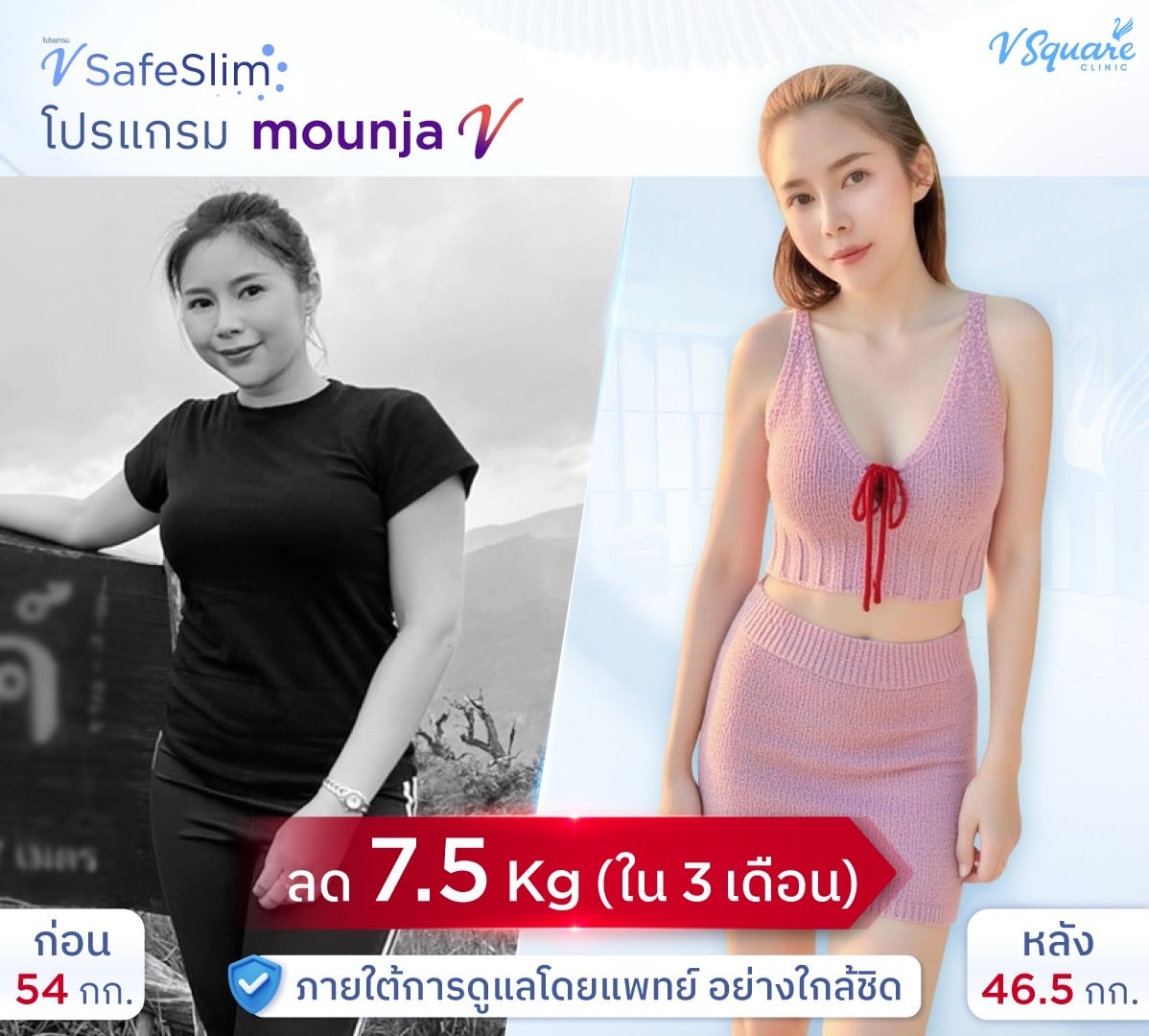 รีวิว V Safe Slim