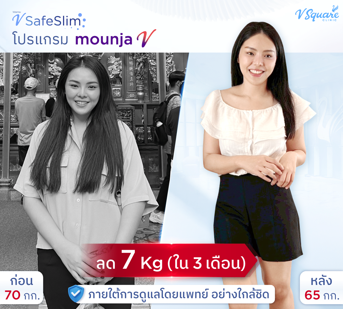 รีวิว V Safe Slim