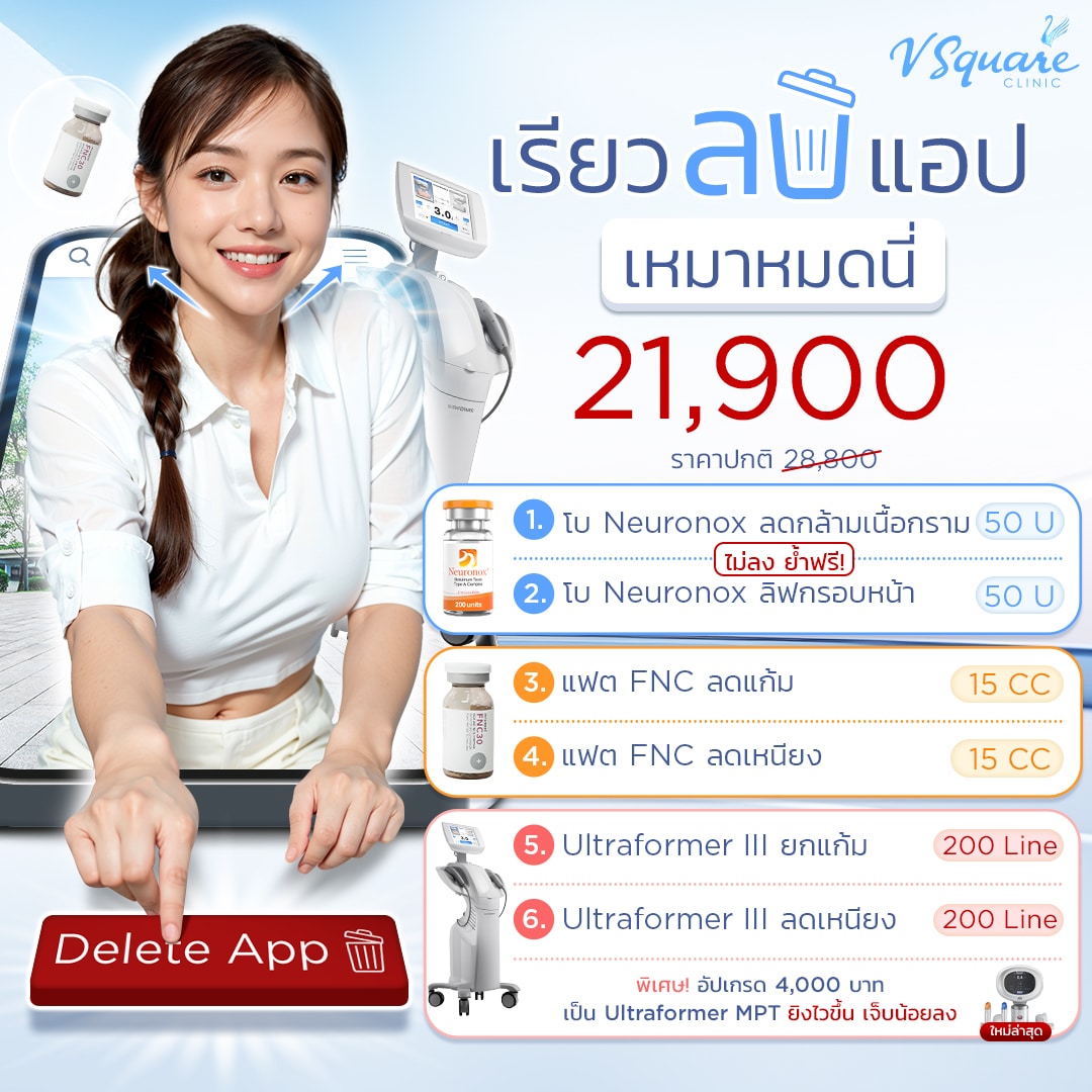 โปรเรียวลบแอป