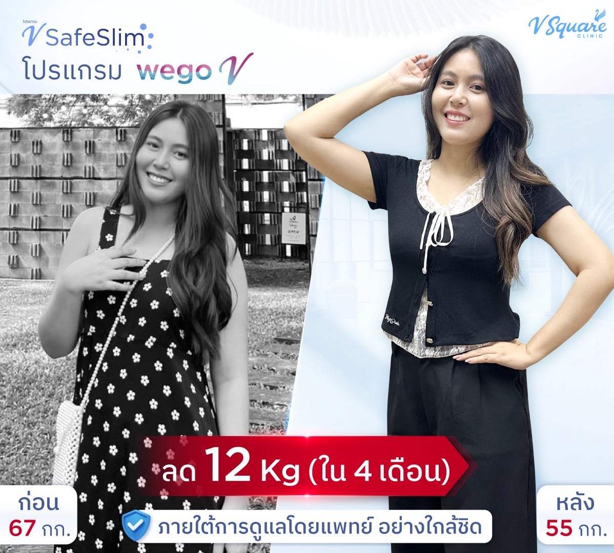 รีวิว V Safe Slim