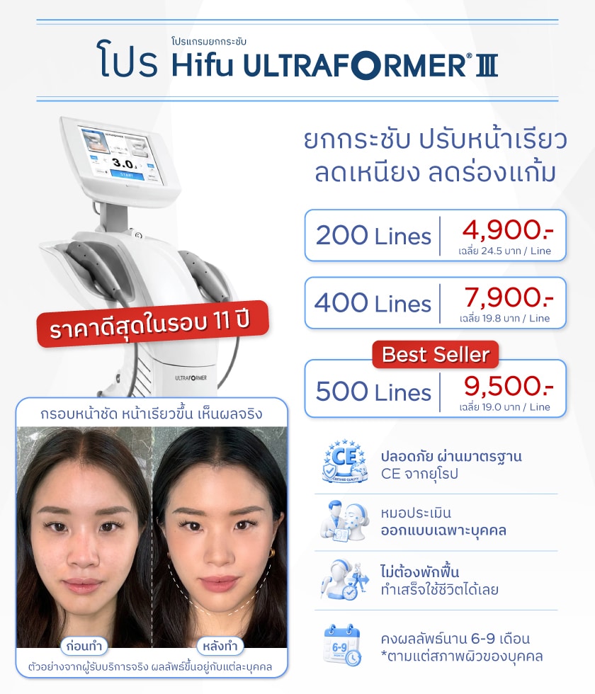 โปรโมชั่น Hifu