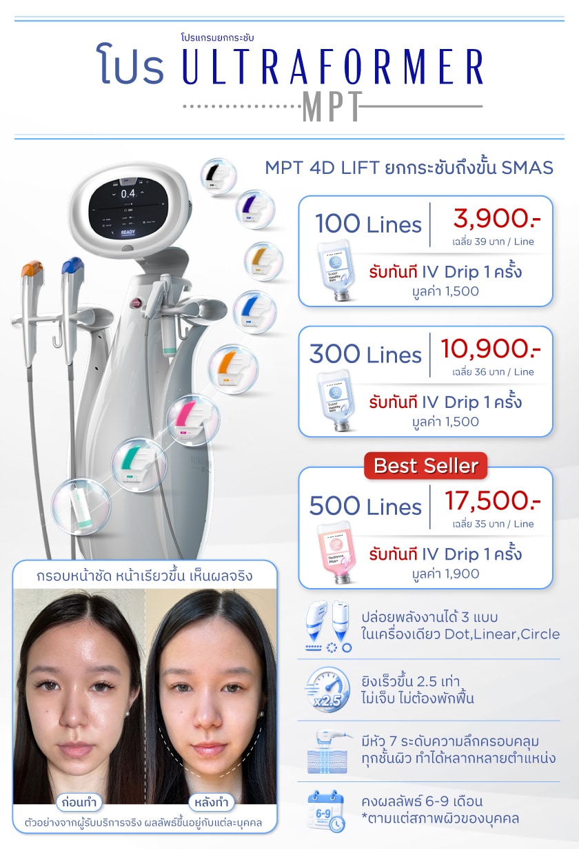 โปรโมชั่น Ultraformer