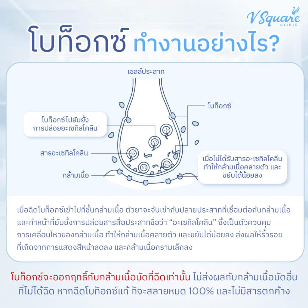 หลักการทำงานของโบท็อก Allergan