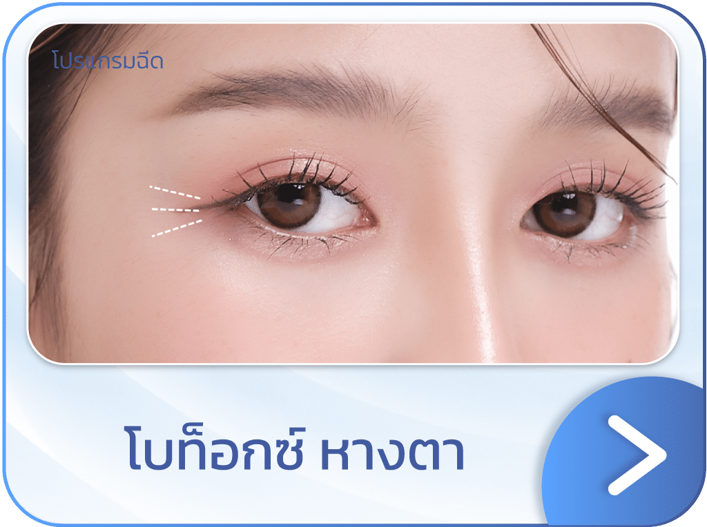 โบท็อกยกหางตา