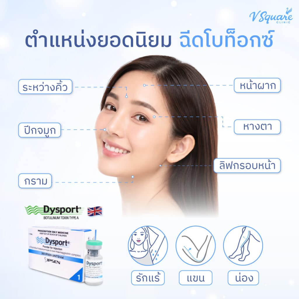 ตำแหน่งฉีดโบท็อก Dysport