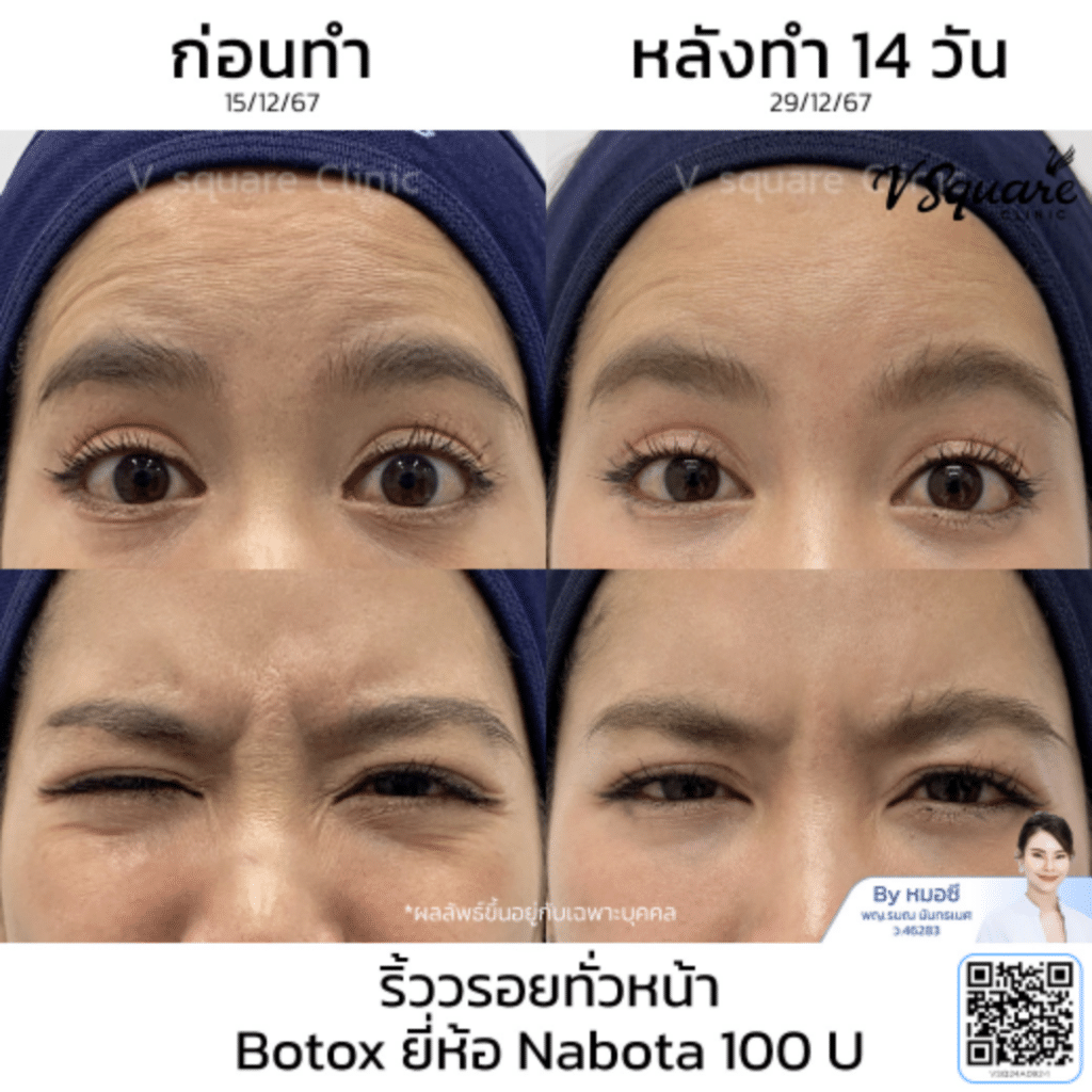 nabota_คุณกุ๊กกิ๊ก_โดยหมอซี