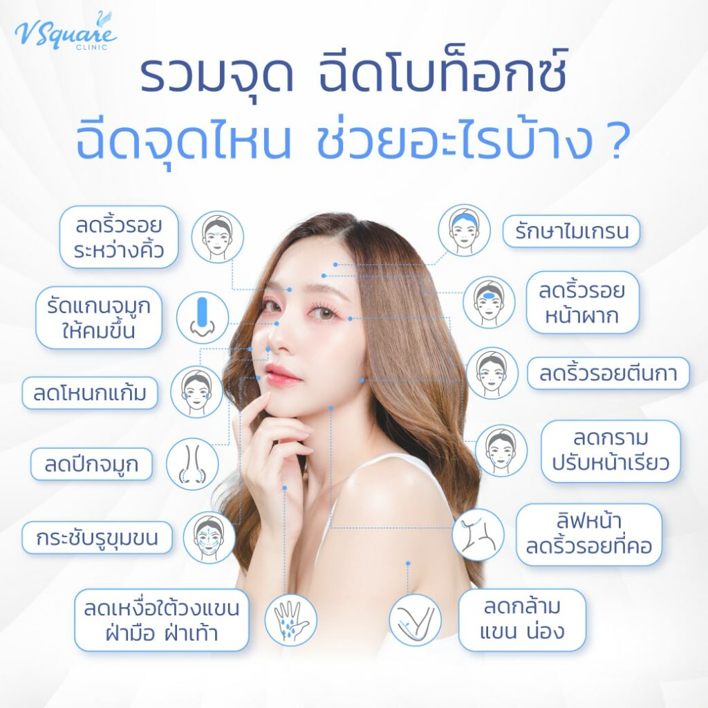 โบท็อกฉีดจุดไหน