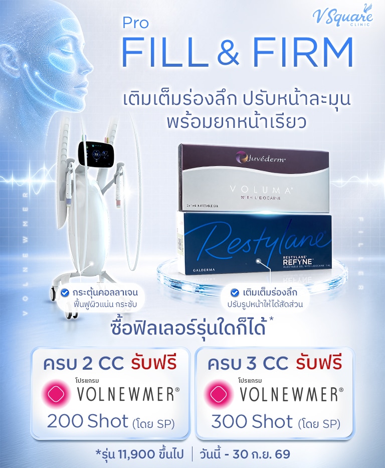 โปรฟิลเลอร์