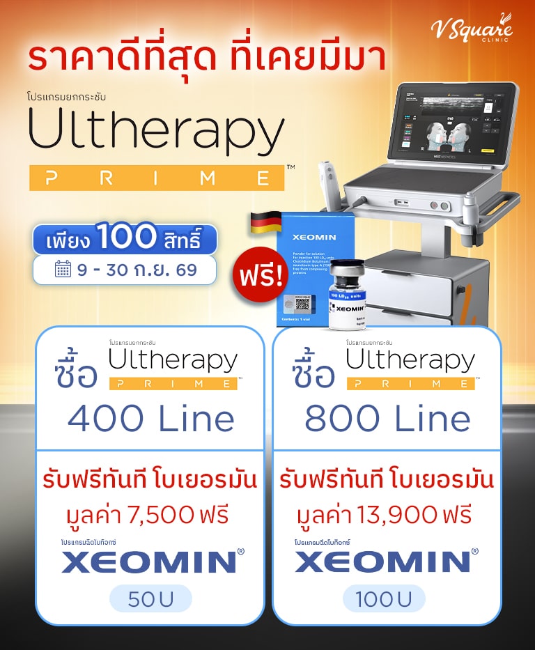 Ultherapy Prime