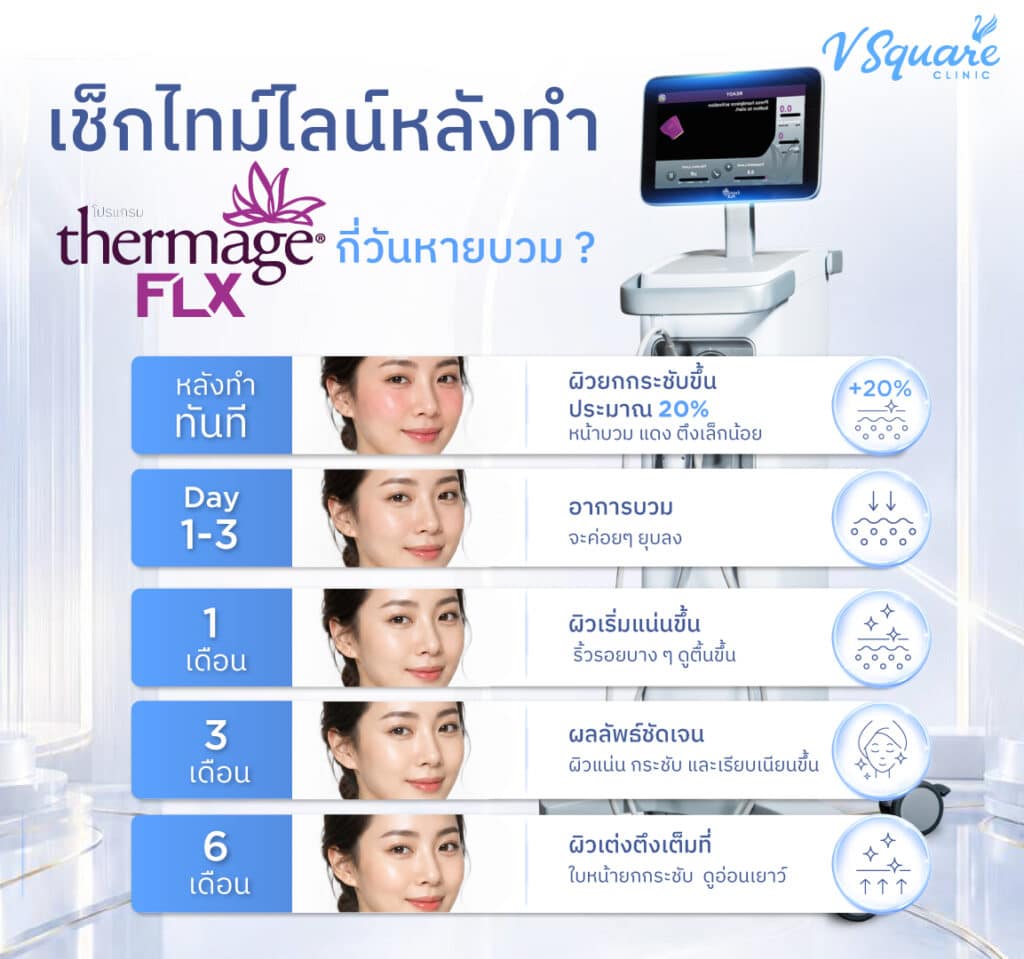 ไทม์ไลน์หลังทำ Thermage