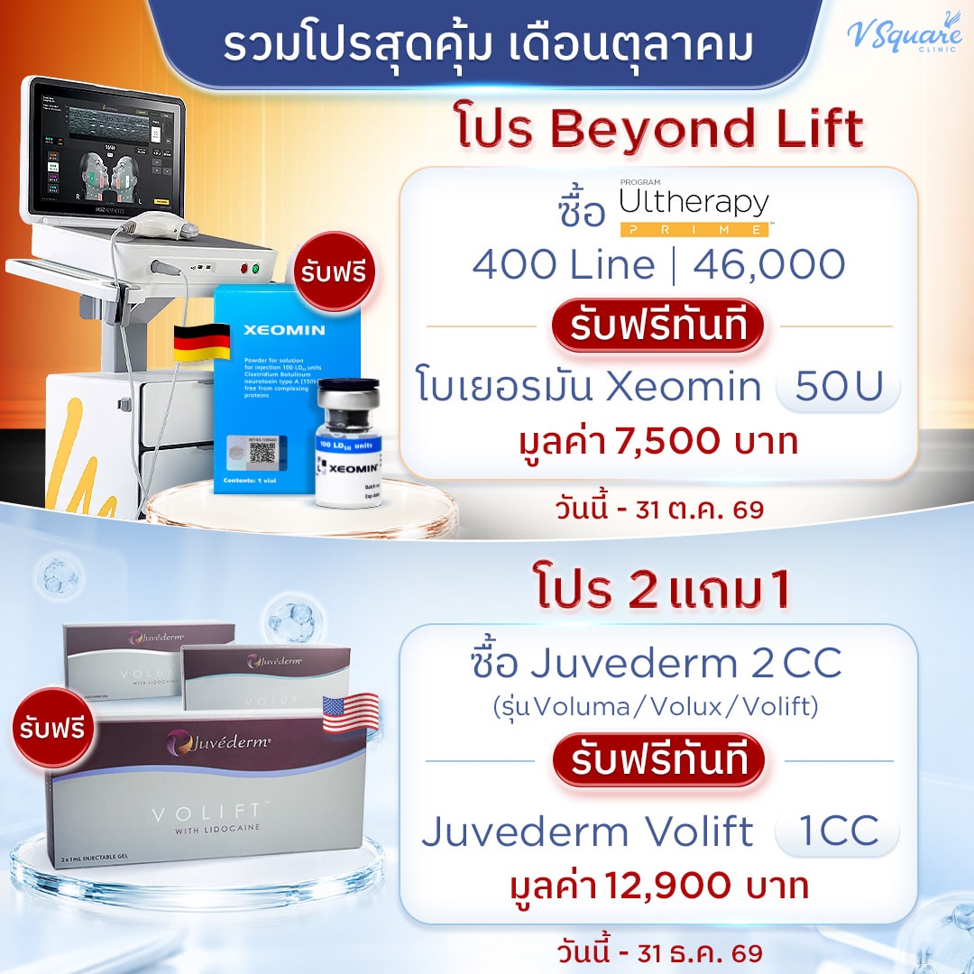 โปร Beyond Lift + โปร 2 แถม 1